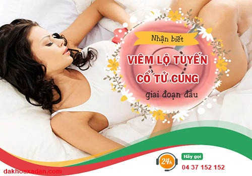 viêm lộ tuyến cổ tử cung