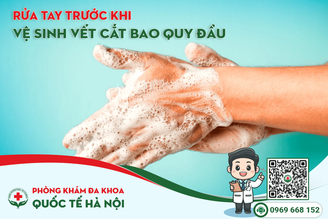 Rửa tay trước khi vệ sinh vết cắt bao quy đầu