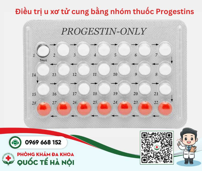 Điều trị u xơ tử cung bằng nhóm thuốc Progestins
