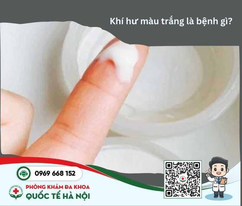 Khí hư màu trắng là bệnh gì?