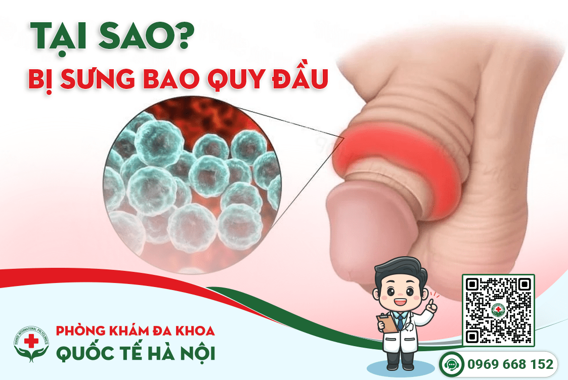 Tại sao bị sưng bao quy đầu