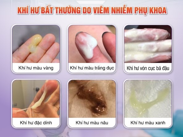 KHÍ HƯ RA NHIỀU LÀ BIỂU HIỆN CỦA BỆNH GÌ ? 2 kham khi hu bat thuong