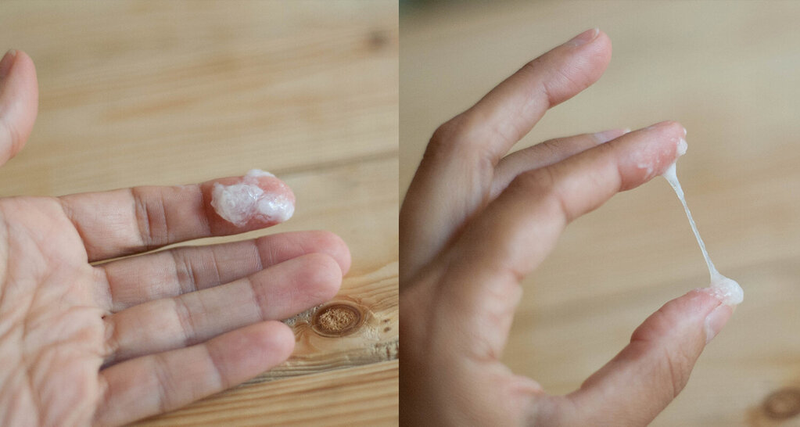 KHÍ HƯ CÓ MÀU TRẮNG: NGUYÊN NHÂN VÀ CÁCH ĐIỀU TRỊ 1 khi hu mau trang