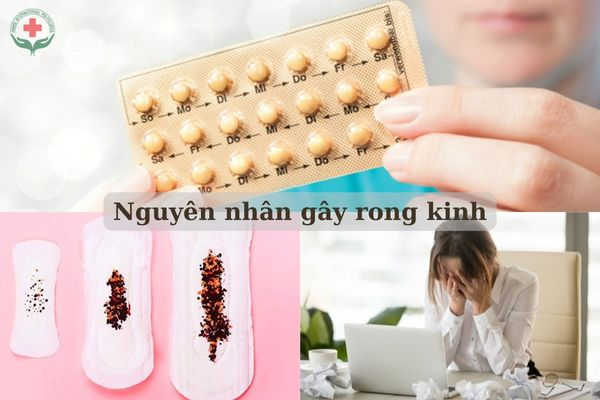 nguyên nhân gây rong kinh