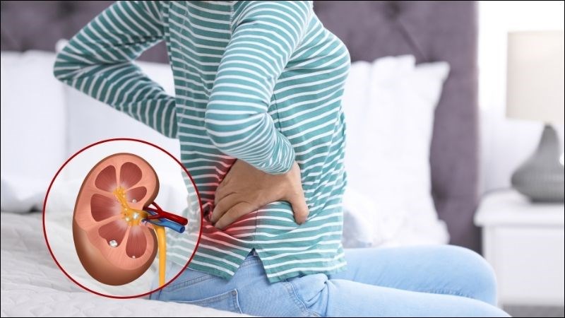 14 NGUYÊN NHÂN GÂY ĐAU BỤNG DƯỚI BÊN TRÁI Ở NỮ 5 soi than bao nhieu mm thi phai mo kich thuoc soi nguy hiem3 800x450 1