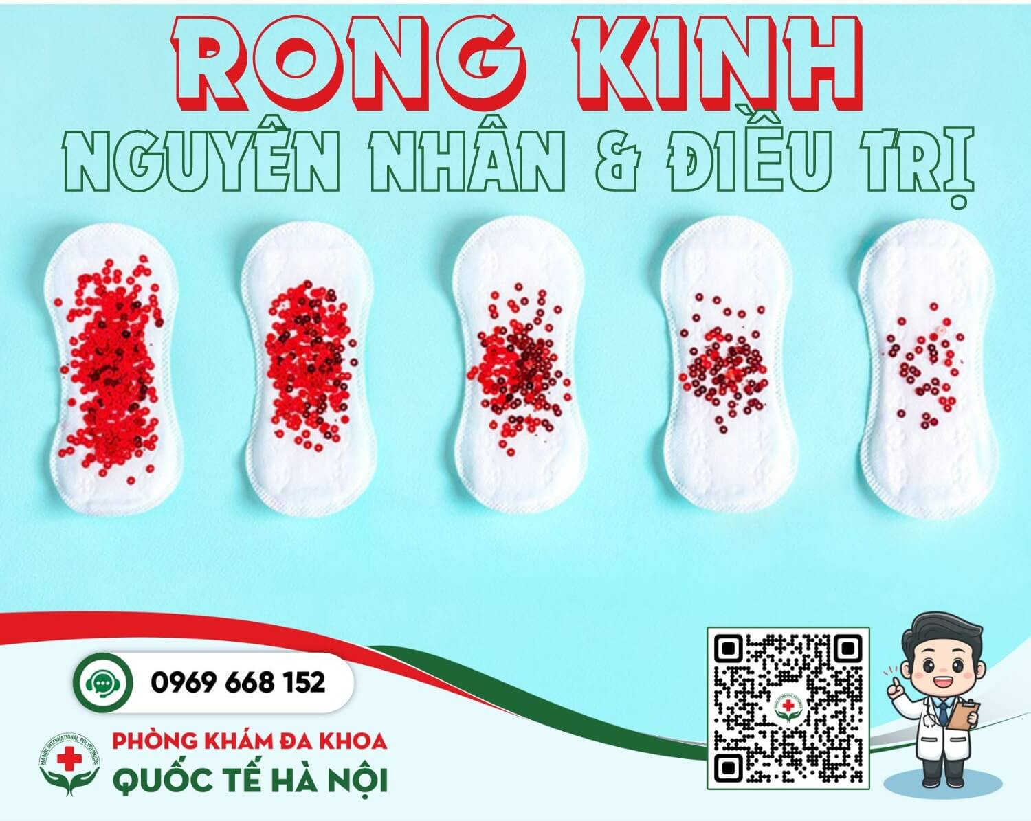 rong-kinh-la-gi-dau-hieu-va-nguyen-nhan