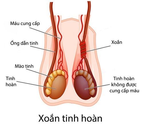 xoan tinh hoan gay sung dau tinh hoan trai