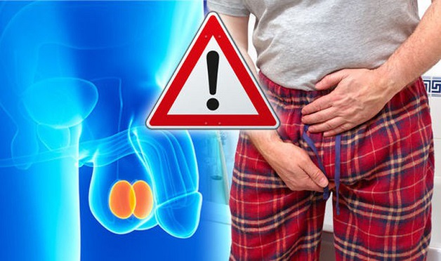 ĐAU TINH HOÀN BÊN PHẢI: NGUYÊN NHÂN, TRIỆU CHỨNG & CÁCH ĐIỀU TRỊ 2 Triệu chứng đau tinh hoàn bên phải