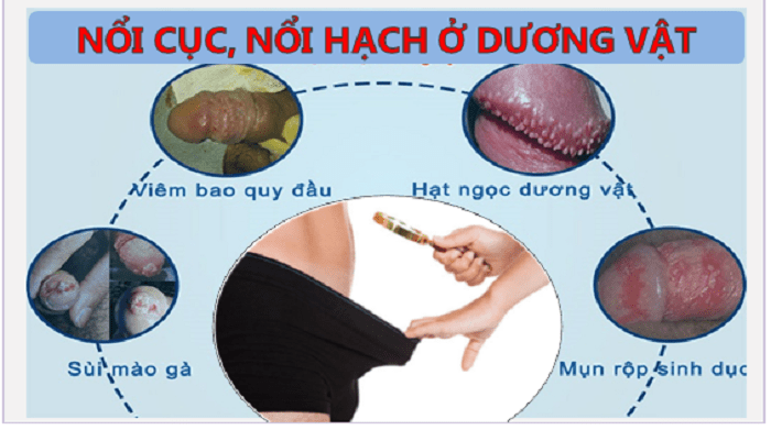 giai-dap-noi-hach-o-duong-vat-la-bi-gi-co-nguy-hiem-khong