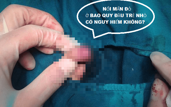 noi man do o bao quy dau