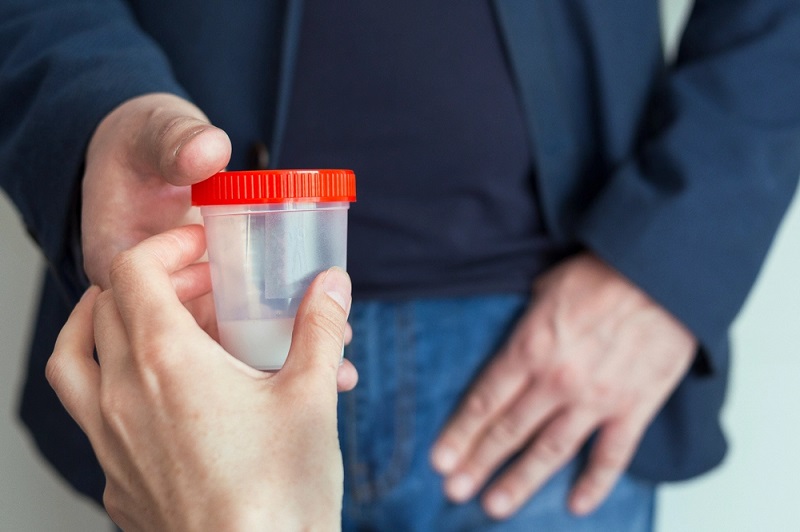 xet nghiem tinh dich do