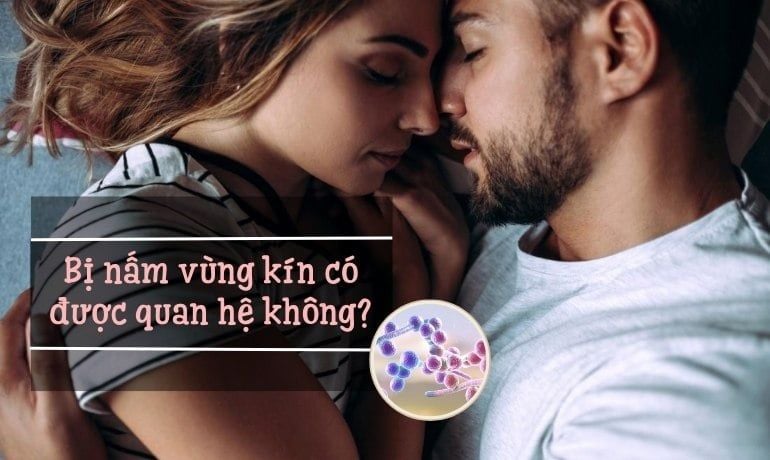 BỊ NẤM VÙNG KÍN: DẤU HIỆU VÀ NGUYÊN NHÂN 5 bi nam co quan he duoc khong
