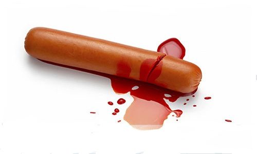 DƯƠNG VẬT CHẢY MÁU SAU KHI QUAN HỆ: NGUYÊN NHÂN, MỨC ĐỘ NGUY HIỂM VÀ CÁCH XỬ LÝ ĐÚNG 1 duong vat chay mau sau khi quan he