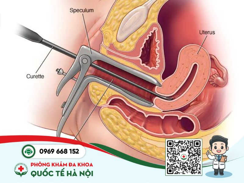 CÁCH PHÁ THAI BẰNG THUỐC NAM CÓ AN TOÀN KHÔNG? 7 Phương pháp phá thai ngoại khoa