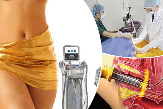 TRẺ HOÁ ÂM ĐẠO: QUY TRÌNH, CHI PHÍ VÀ CÔNG NGHỆ THỰC HIỆN 3 Thủ thuật trẻ hoá vùng kín