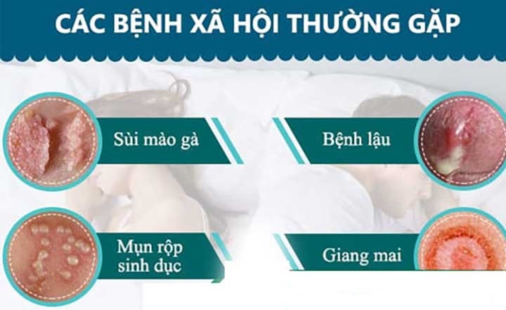 BỆNH XÃ HỘI Ở NỮ GIỚI NGUY HIỂM KHÔNG? DẤU HIỆU NHẬN BIẾT & CÁCH PHÒNG TRÁNH 1 cac benh xa hoi