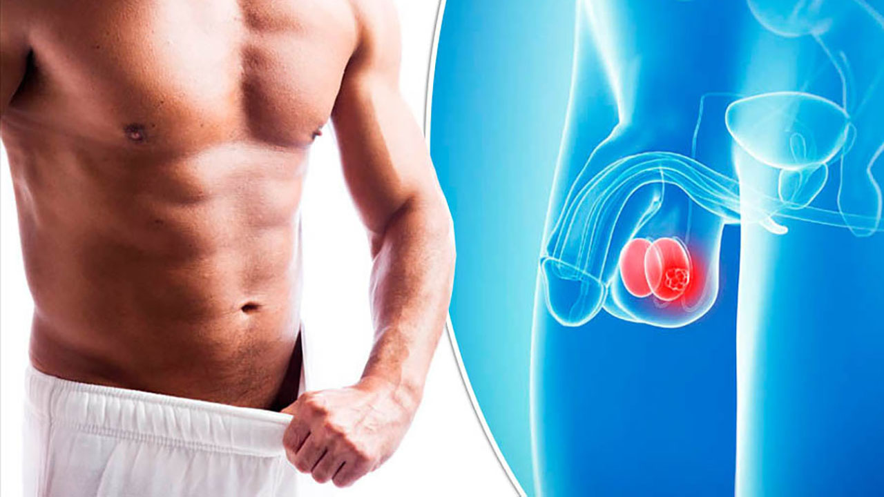 ĐAU TINH HOÀN SAU KHI QUAN HỆ: NGUYÊN NHÂN VÀ CÁCH CHỮA TRỊ 3 Viêm tinh hoàn - Nguyên nhân đau tinh hoàn sau khi quan hệ