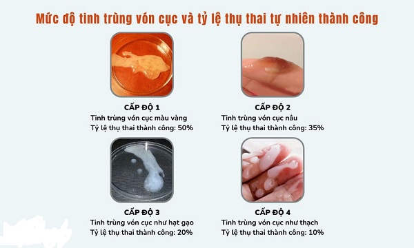 CÁCH CHỮA TINH TRÙNG VÓN CỤC TẠI NHÀ ĐƠN GIẢN - HIỆU QUẢ 2 tinh trung von cuc co con duoc khong 1