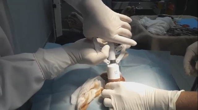 Cắt bao quy đầu có ảnh hưởng tới kích thước dương vật không? 3 Cắt bao quy đầu có ảnh hưởng tới kích thước dương vật không