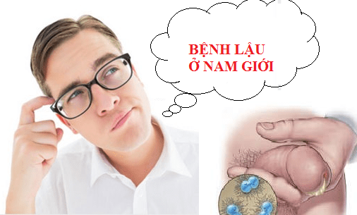 benh-lau-o-nam