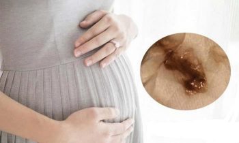 ba bau ra dich mau nau nguy hiem k