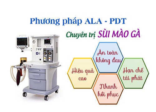 Điều trị bệnh sùi mào gà bằng phương pháp quang động học ALA- PDT