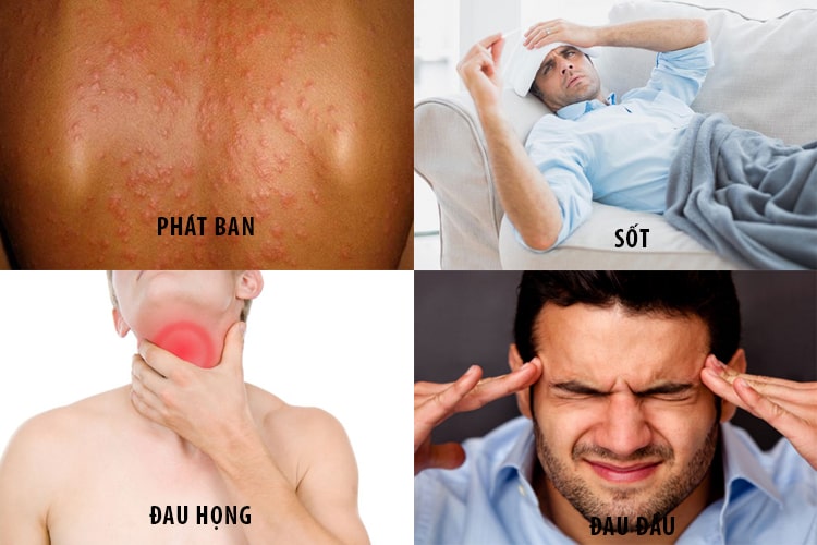 DẤU HIỆU HIV - NHẬN BIẾT SỚM ĐỂ NGĂN CHẶN NGUY CƠ TIẾN TRIỂN THÀNH AIDS 4 Dấu hiệu HIV cần đi khám ngay