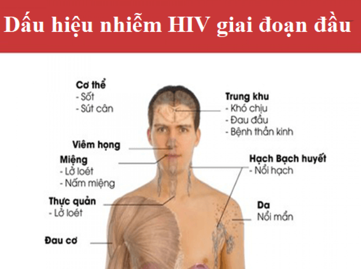 Tác hại của kỳ thị, phân biệt đối xử đối với người nhiễm HIV