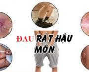 nguyen-nhan-cach-tri-dau-rat-hau-mon-tai-nha