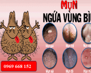 noi-mun-o-tinh-hoan-canh-bao-benh-gi