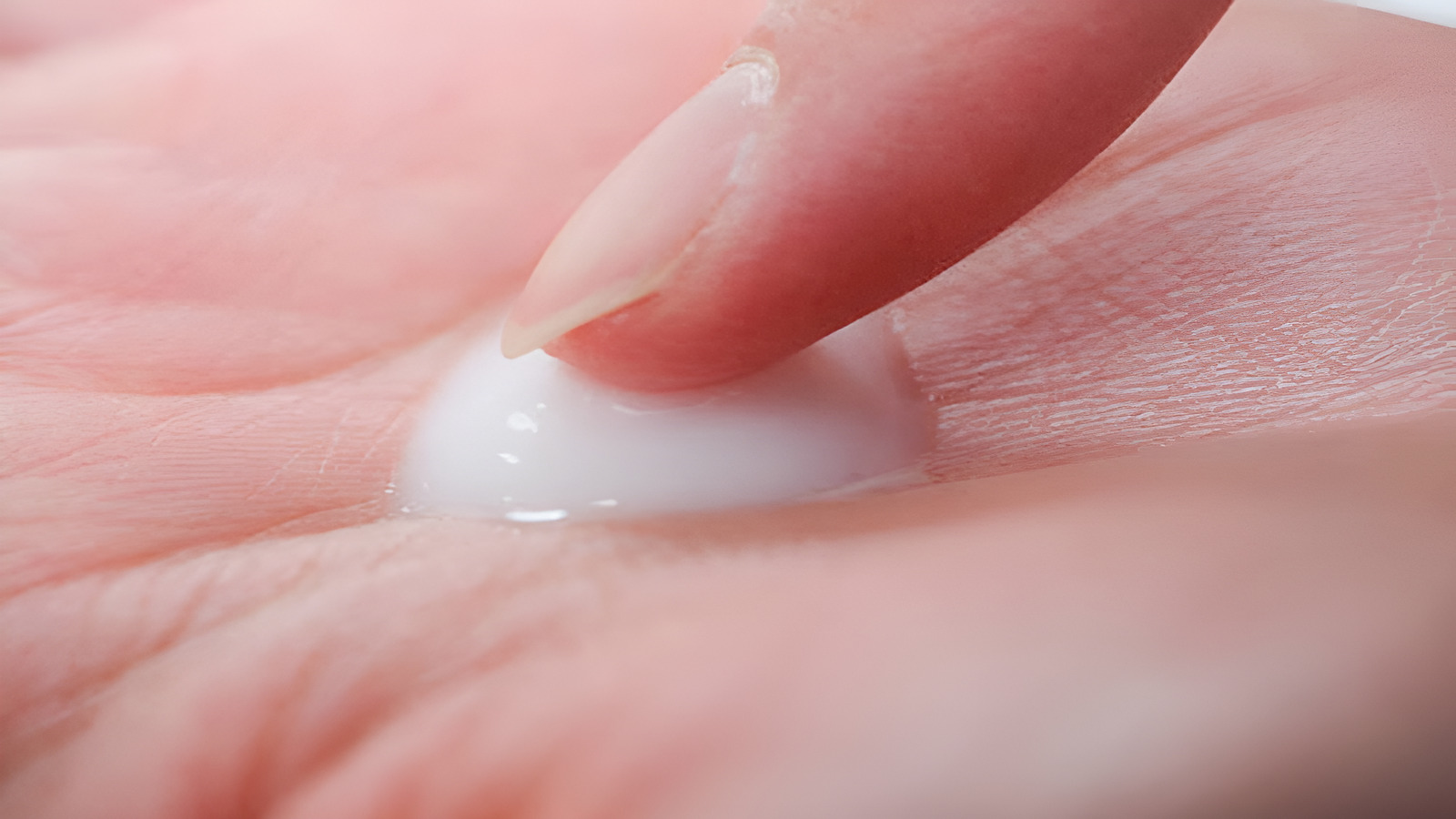 NHẬN BIẾT KHÍ HƯ BÌNH THƯỜNG VÀ KHÍ HƯ BỆNH LÝ 1 Khí hư màu trắng là mắc bệnh gì?