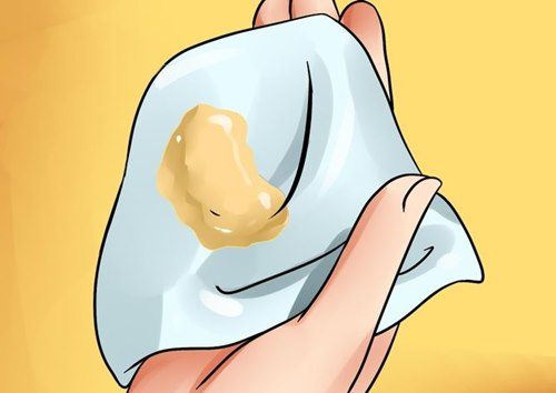 KHÍ HƯ MÀU VÀNG CÓ PHẢI BỆNH KHÔNG ? 1 Khí hư màu vàng có phải bệnh không?