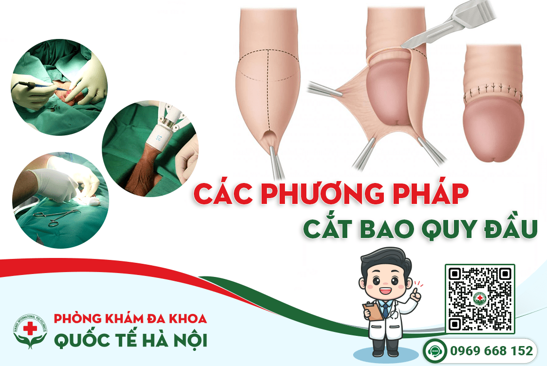 3-phuong-phap-cat-bao-quy-dau-pho-bien-va-hieu-qua-nhat-hien-nay