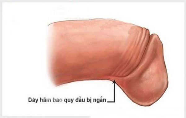 ngan-day-ham-bao-quy-dau