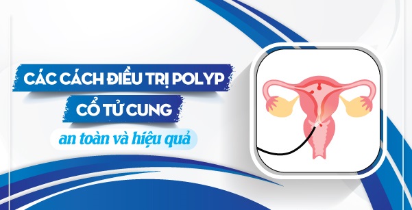 CÁCH ĐIỀU TRỊ POLYP CỔ TỬ CUNG HIỆU QUẢ HIỆN NAY 1 cách điều trị polyp cổ tử cung