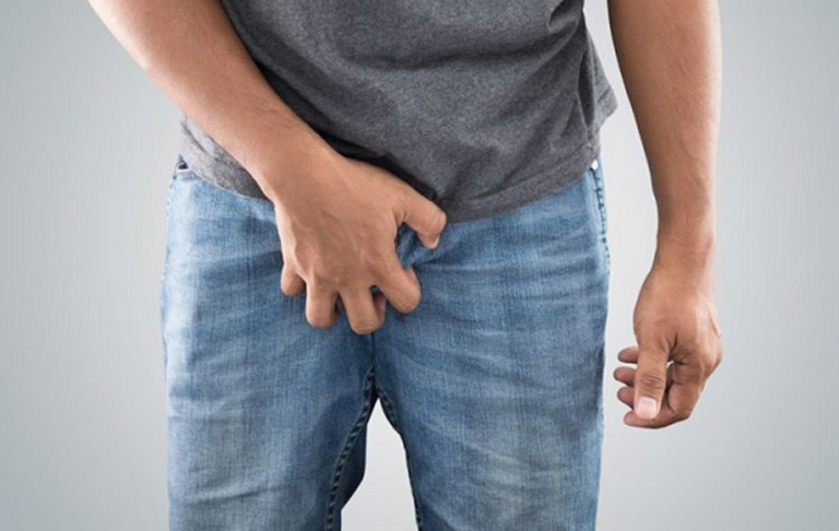 CÁCH TRỊ NGỨA BAO QUY ĐẦU AN TOÀN, HIỆU QUẢ, CHUẨN Y KHOA 1 cach tri ngua bao quy dau 1