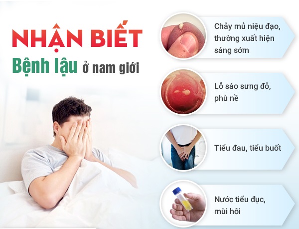 DƯƠNG VẬT CHẢY DỊCH VÀNG LÀ DẤU HIỆU BỆNH GÌ? 2 Dương vật chảy dịch vàng do bệnh lậu