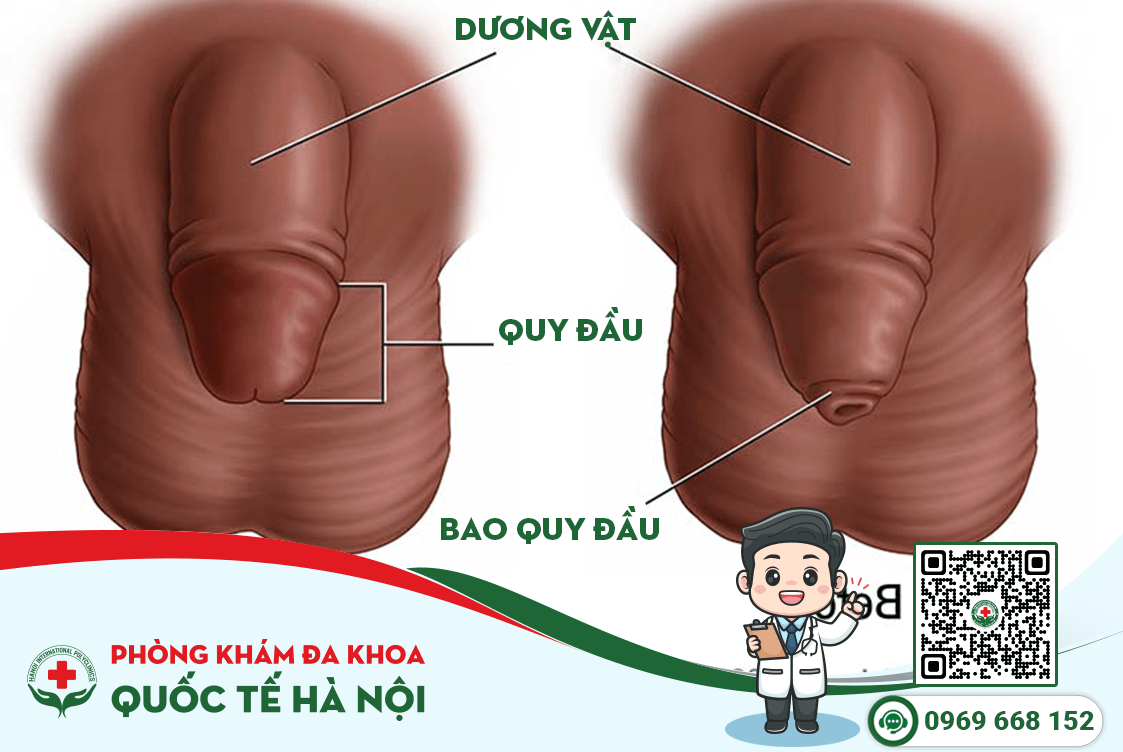 Nhận biết bao quy đầu hẹp