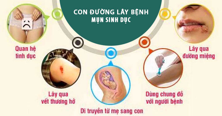 HERPES SINH DỤC LÀ BỆNH GÌ? NGUYÊN NHÂN, TRIỆU CHỨNG VÀ CÁCH ĐIỀU TRỊ 2 con duong lay nhiem herpes sinh duc