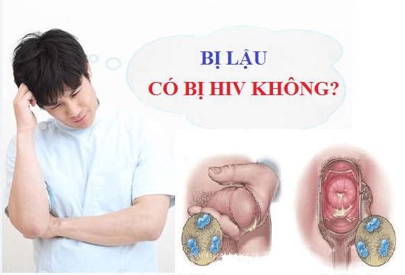 benh-lau-co-phai-hiv-khong