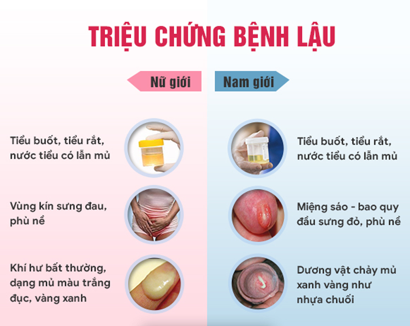 BỆNH LẬU VÀ GIANG MAI GIỐNG NHAU KHÔNG ? 1 benh lau