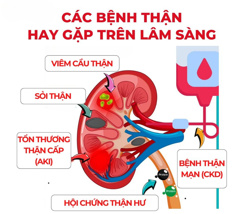 Nước tiểu có màu hồng do bệnh thận