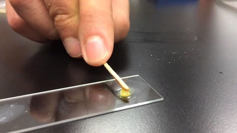 CHI PHÍ ĐIỀU TRỊ VIÊM NIỆU ĐẠO HẾT BAO NHIÊU? BẢNG GIÁ MỚI NHẤT 4 kham va xet nghiem viem nieu dao