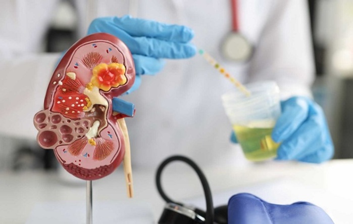 XÉT NGHIỆM NƯỚC TIỂU VÀ NHỮNG LƯU Ý BẠN CHƯA BIẾT 2 muc dich xet nghiem nuoc tieu