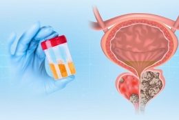 nuoc-tieu-mau-cam-bao-hieu-dieu-gi