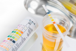 xet-nghiem-nuoc-tieu-va-nhung-thong-tin-lien-quan