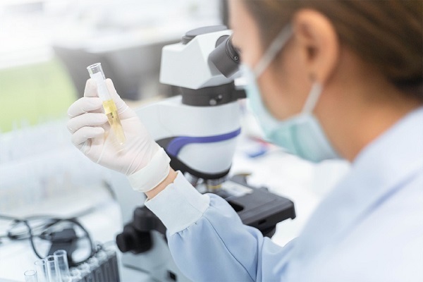 XÉT NGHIỆM NƯỚC TIỂU VÀ NHỮNG LƯU Ý BẠN CHƯA BIẾT 5 xet nghiem