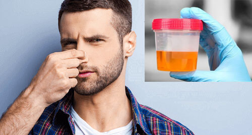 Nguyên nhân nước tiểu có mùi hôi là do đâu