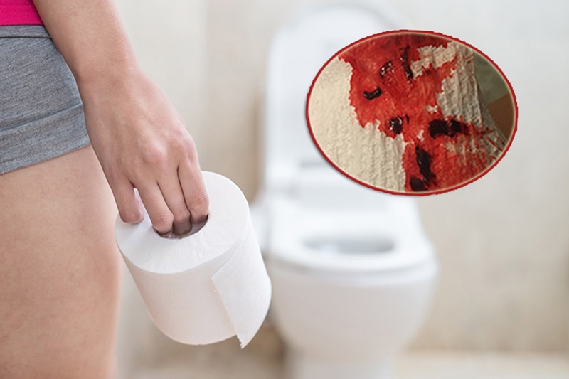 Nguyên nhân quan hệ xong đi tiểu ra máu