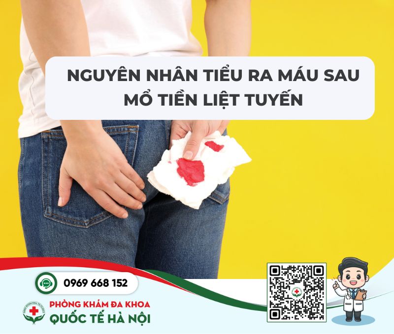 nguyên nhân tiểu ra máu sau mổ tiền liệt tuyến